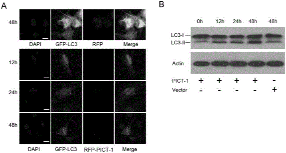PICT-1 protein truncated mutant and application thereof