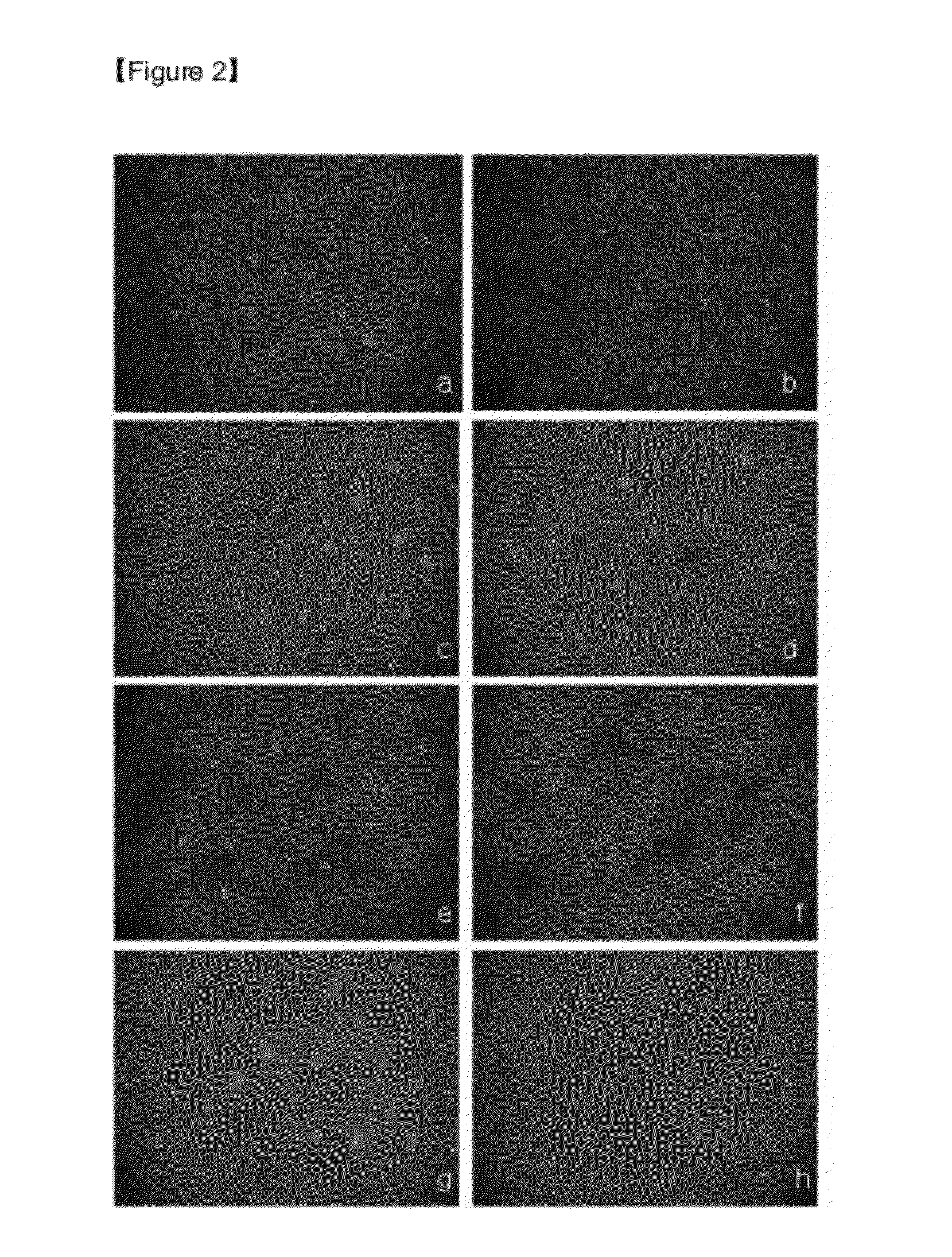 Composition for skin improvement comprising hexamidines and retinoids