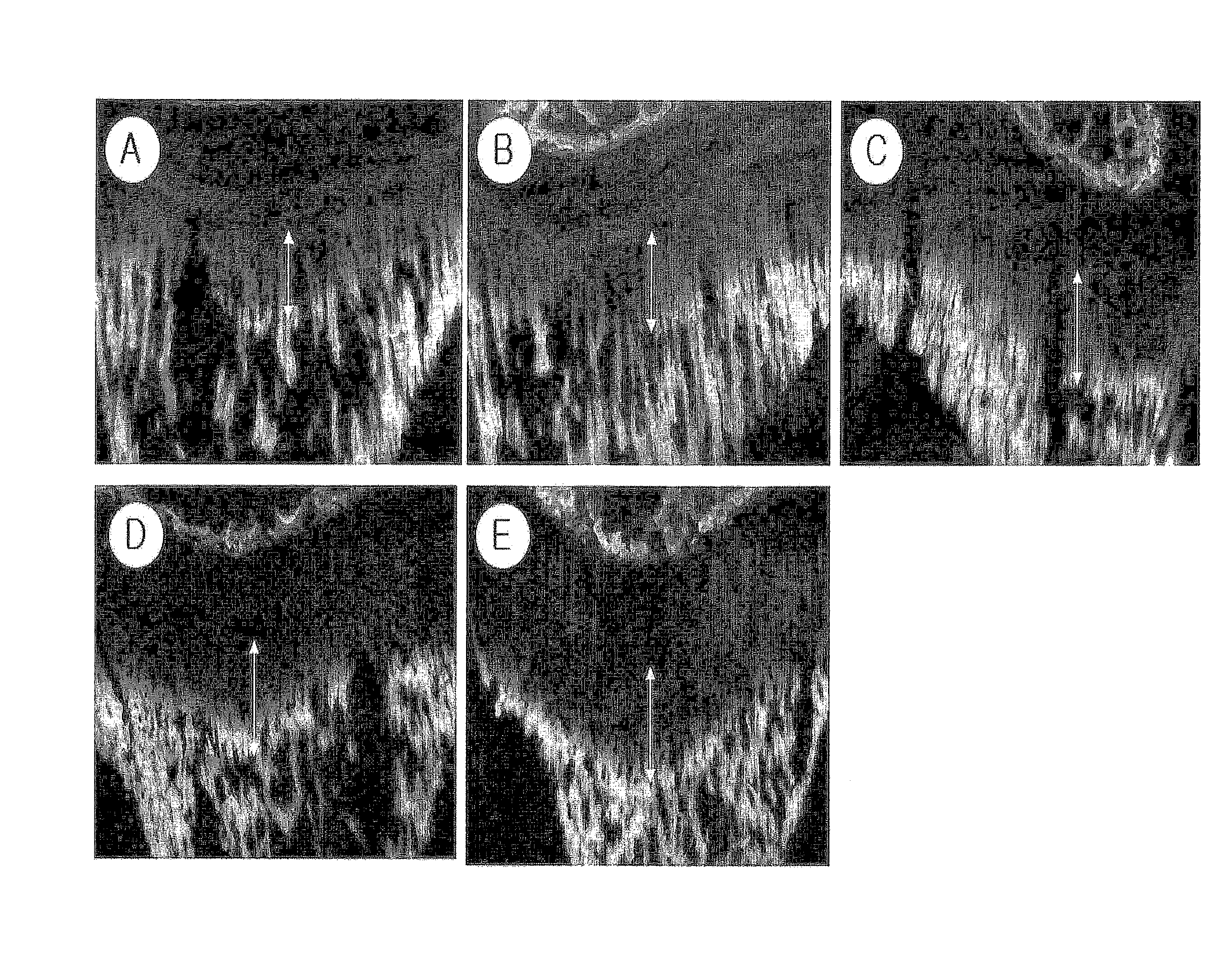 Composition comprising the extract of crude drug complex for stimulating bone growth