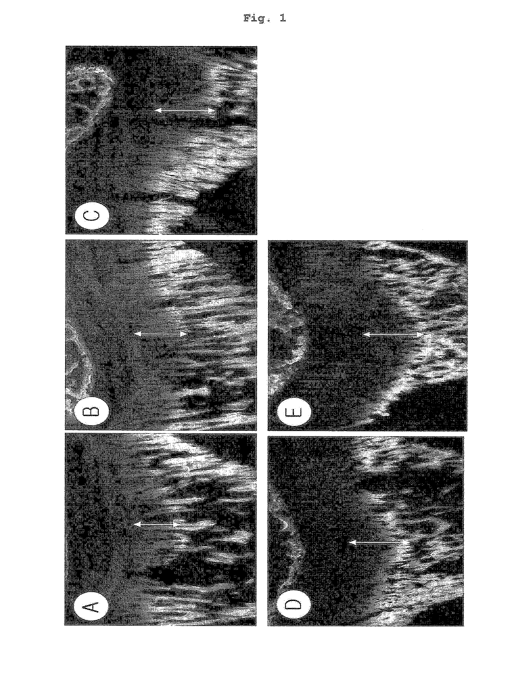 Composition comprising the extract of crude drug complex for stimulating bone growth