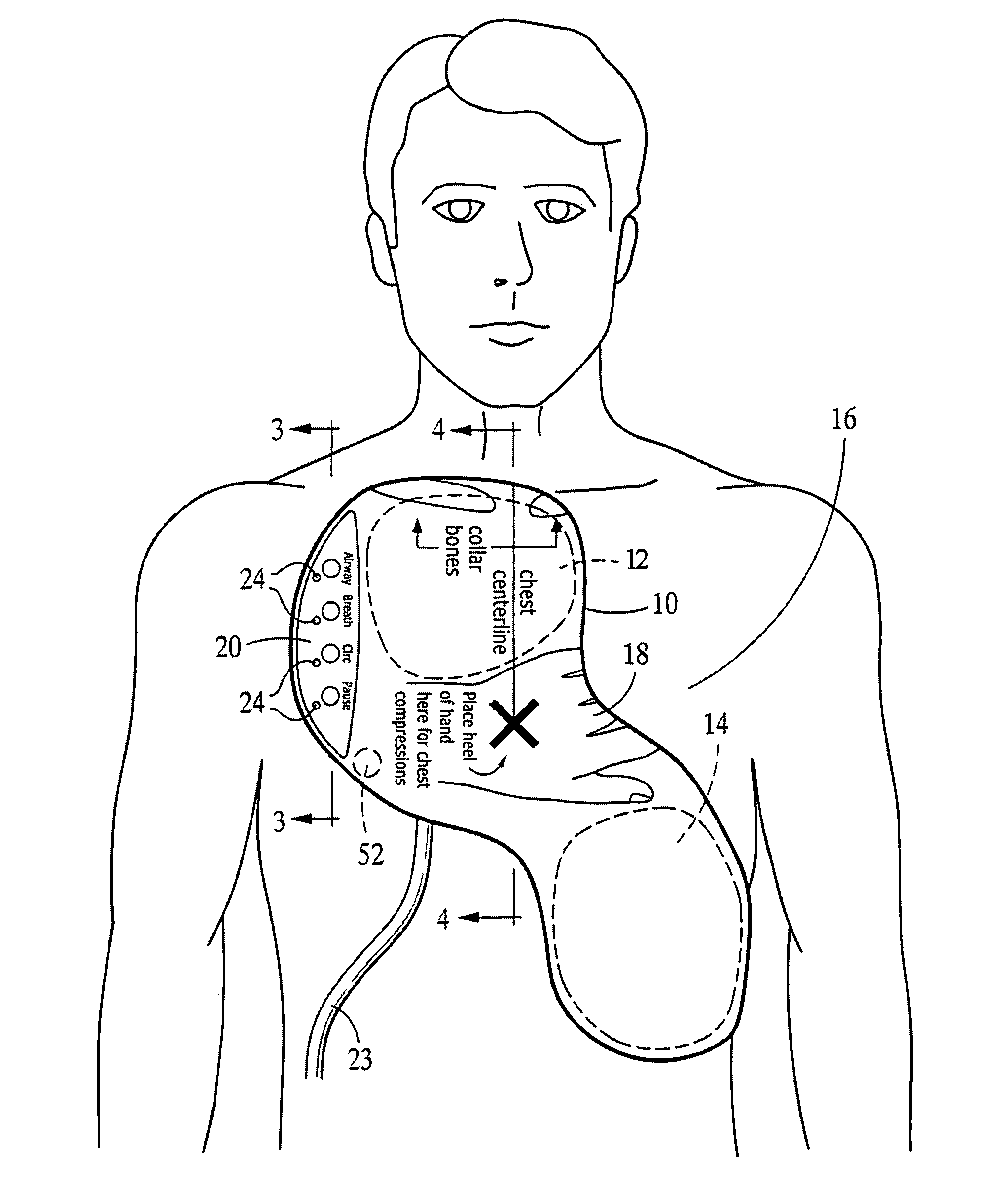Integrated Resuscitation