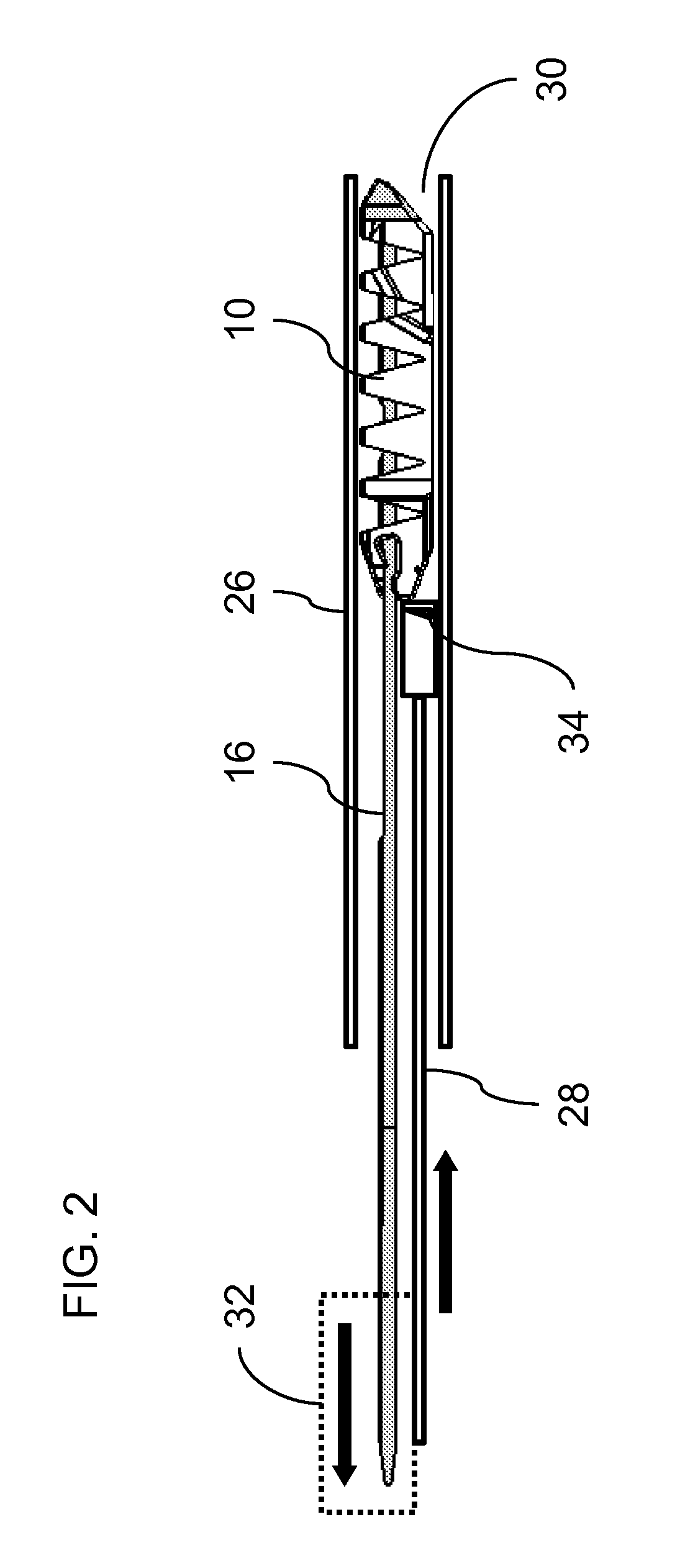 Device and method for spinous process distraction
