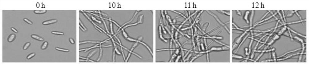 Preparation and regeneration method of protoplasts of No. 1 race of banana fusarium wilt