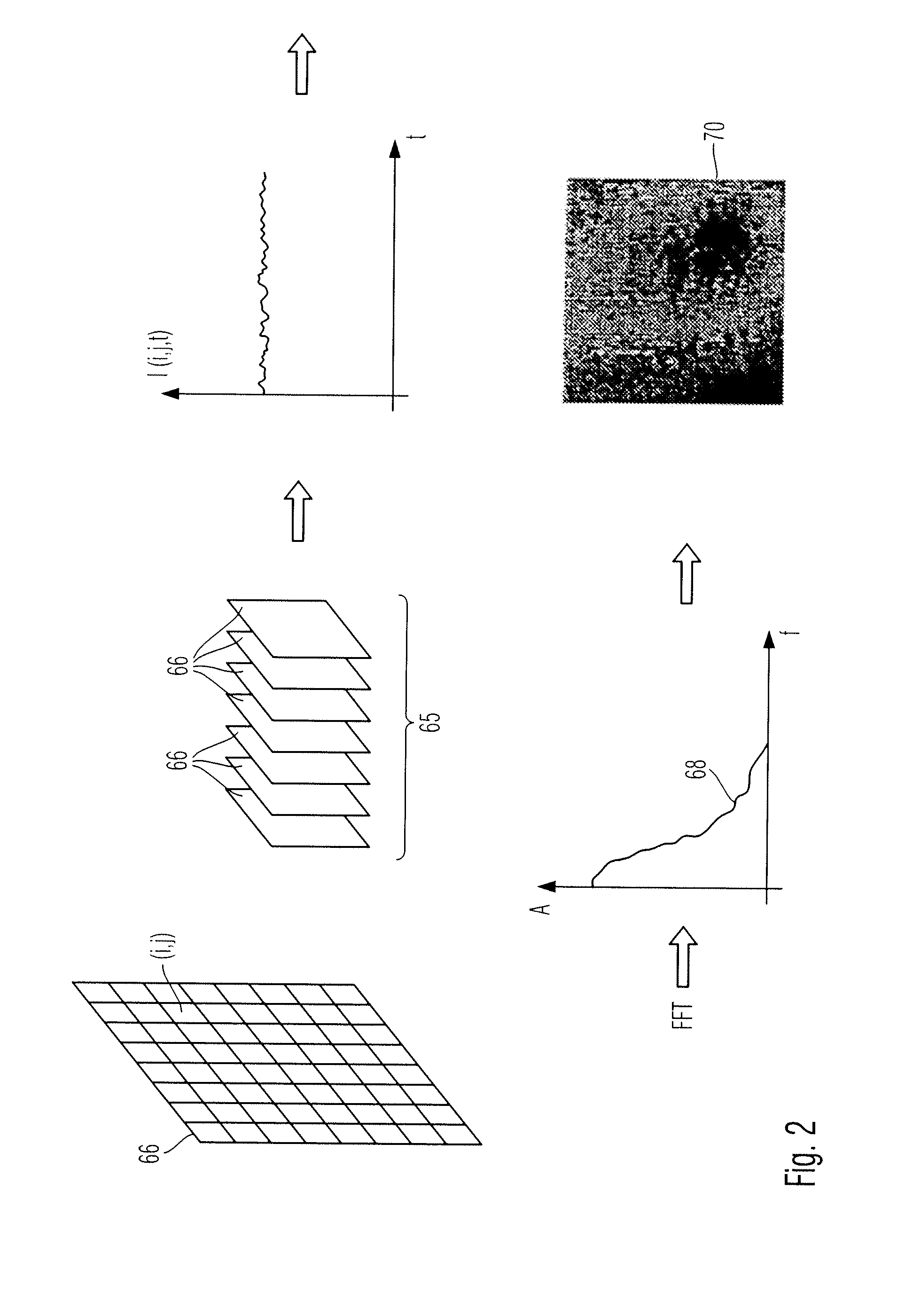 Method and apparatus for displaying a field of a brain of a patient and navigation system for brain surgery