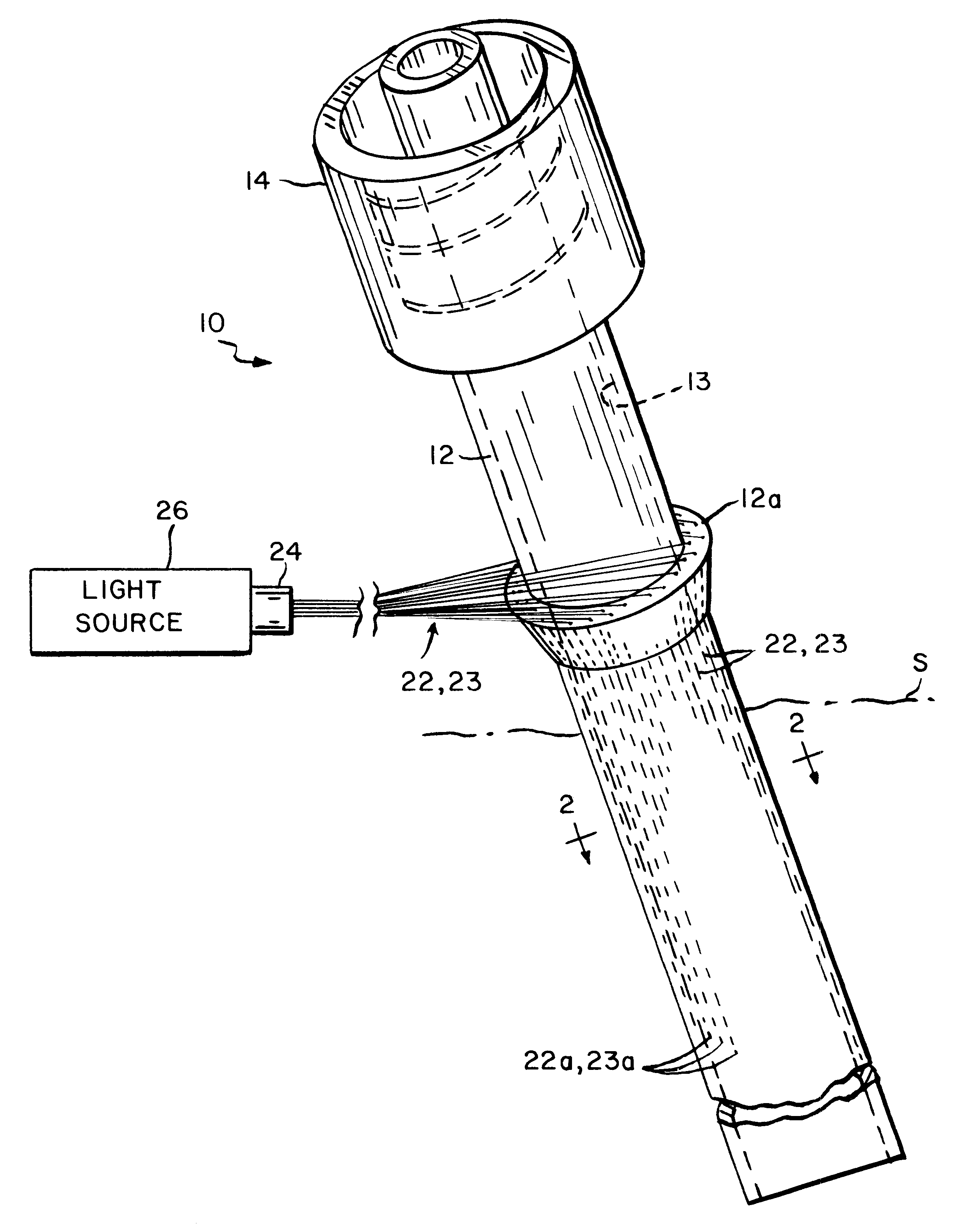 Method and apparatus to prevent infections