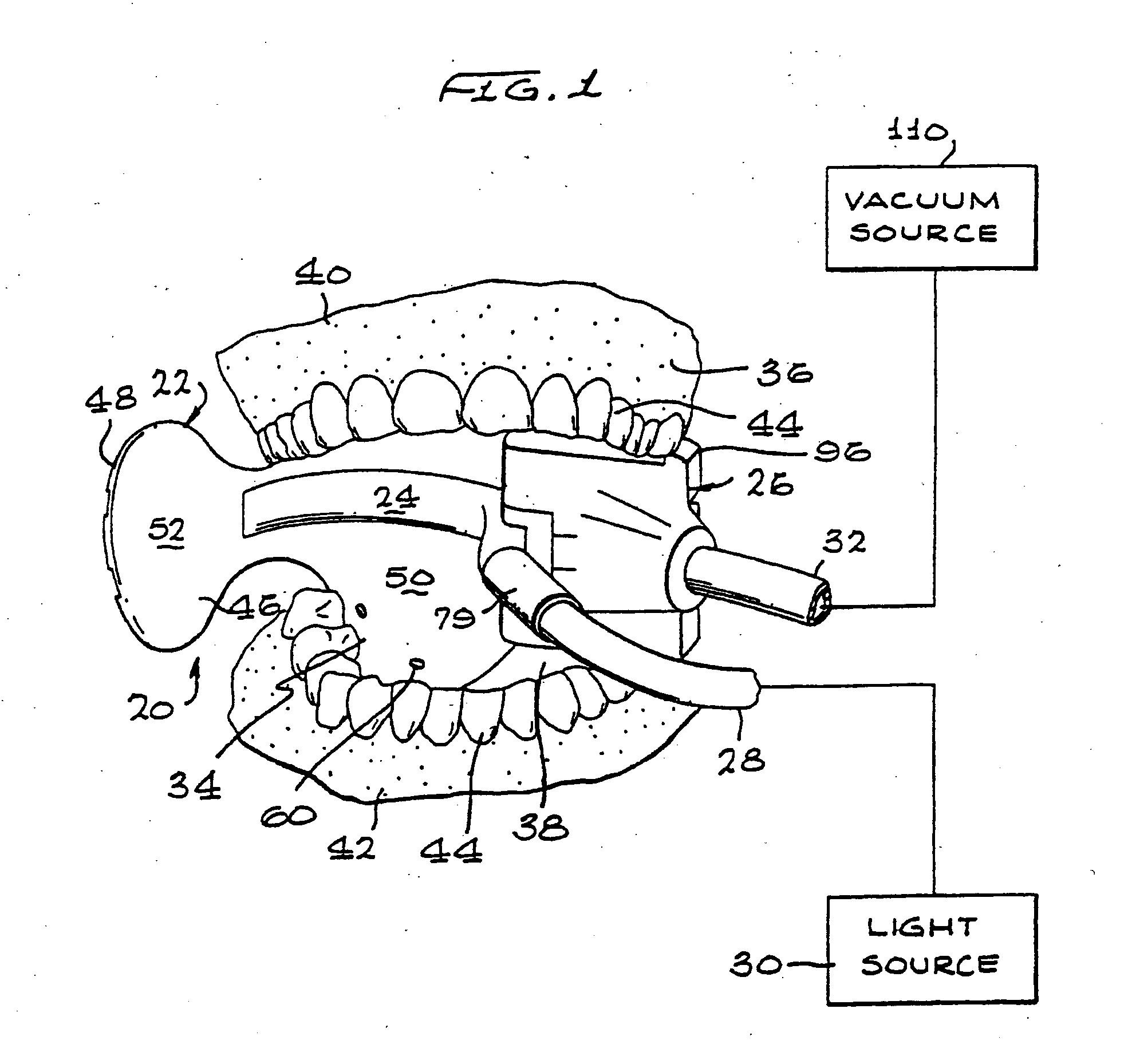 Cooling device and method for intraoral device illumination source