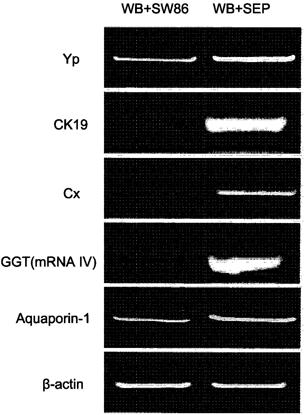 Method for inducing differentiation into bile duct cells and special culture medium of method