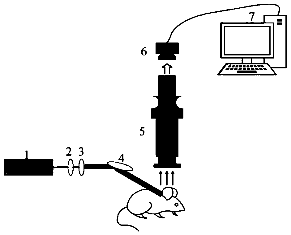 Blood flow velocity monitoring method based on micro blood flow imaging contrast algorithm