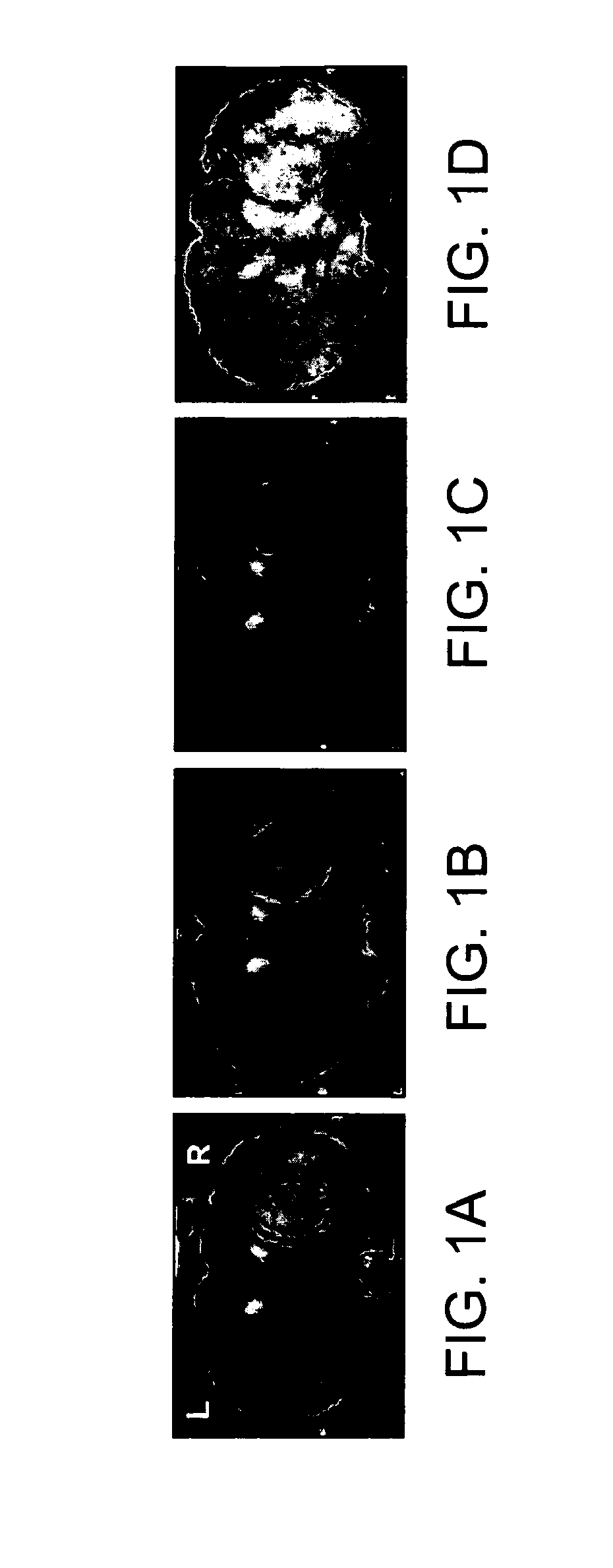 Functionalized Magnetic Nanoparticles and Methods of Use Thereof