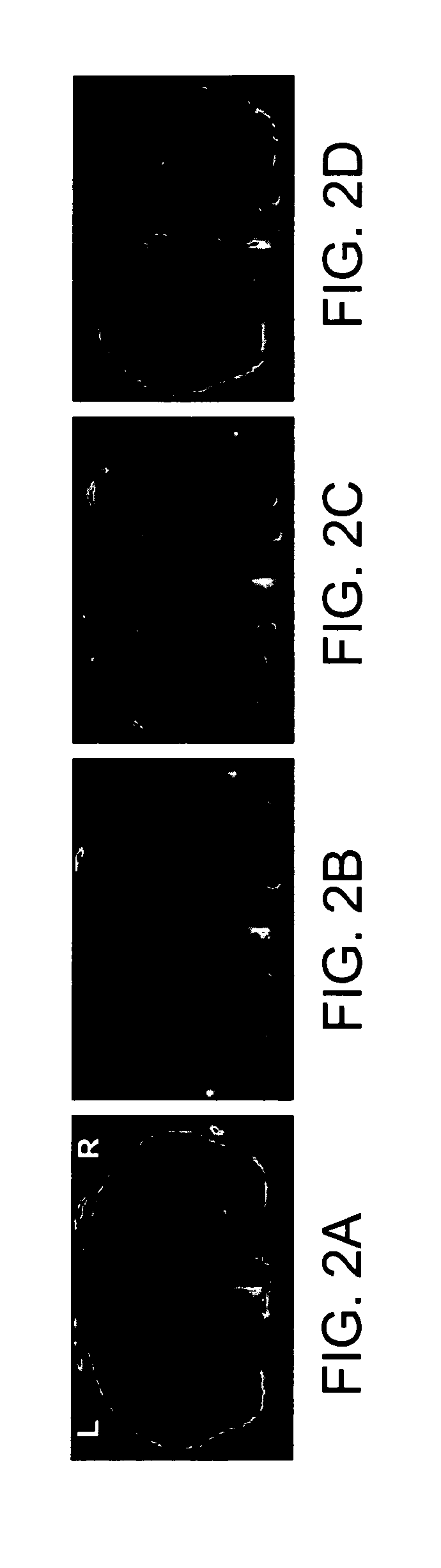 Functionalized Magnetic Nanoparticles and Methods of Use Thereof