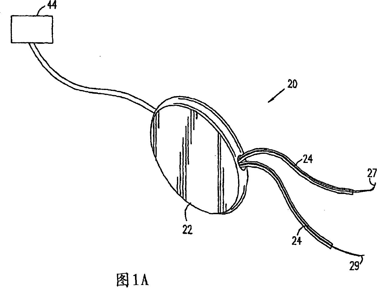 Electrical muscle stimulation to treat fecal incontinence and/or pelvic prolapse