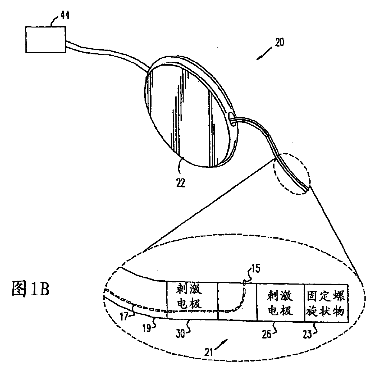 Electrical muscle stimulation to treat fecal incontinence and/or pelvic prolapse