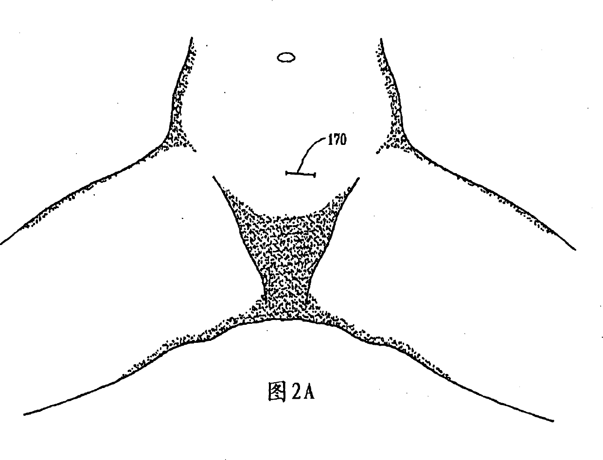 Electrical muscle stimulation to treat fecal incontinence and/or pelvic prolapse