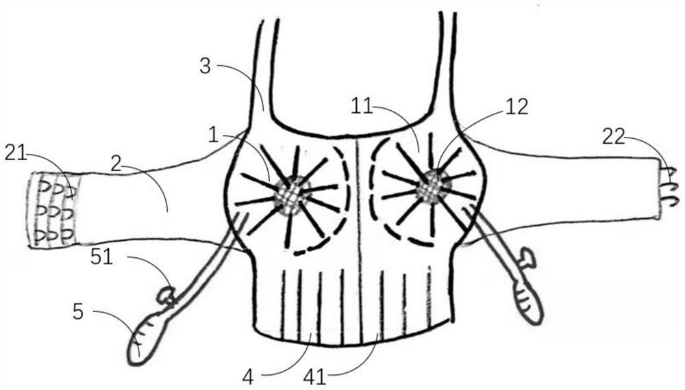 Air bag type local compression hemostat for breasts
