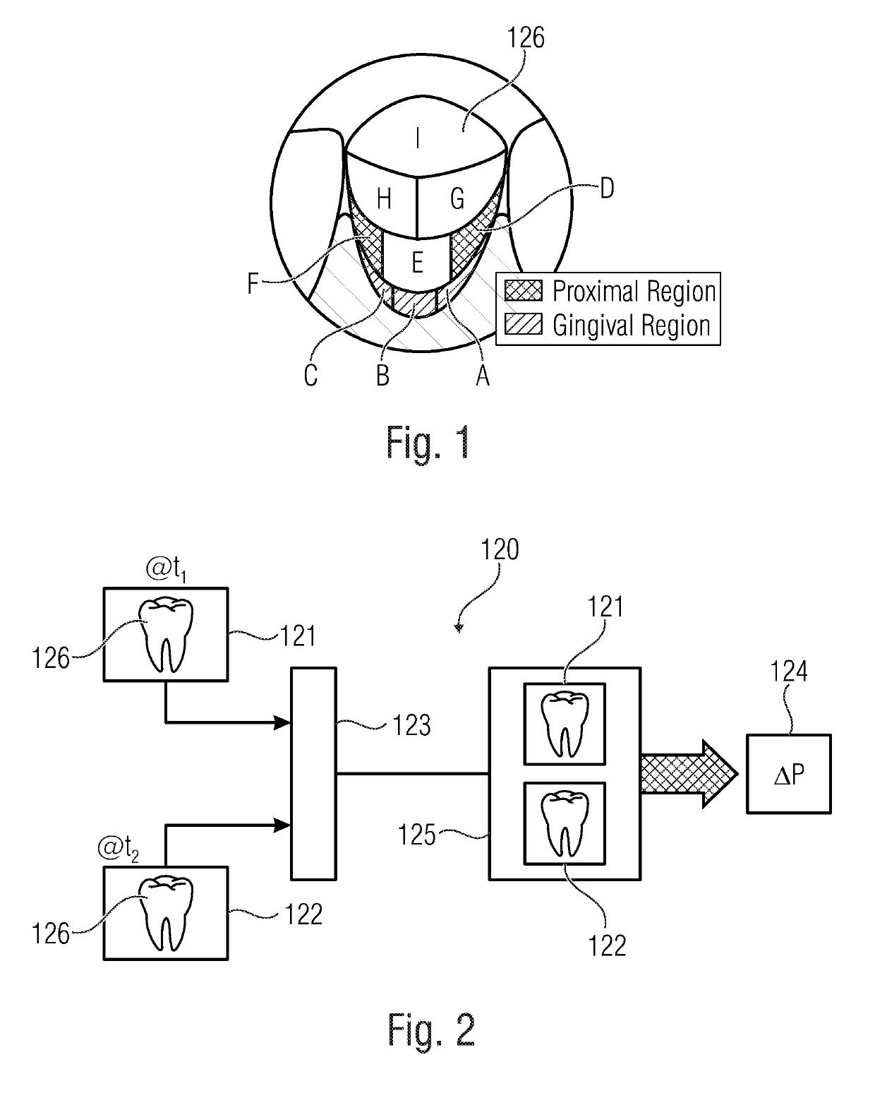 Method and device for determining dental plaque