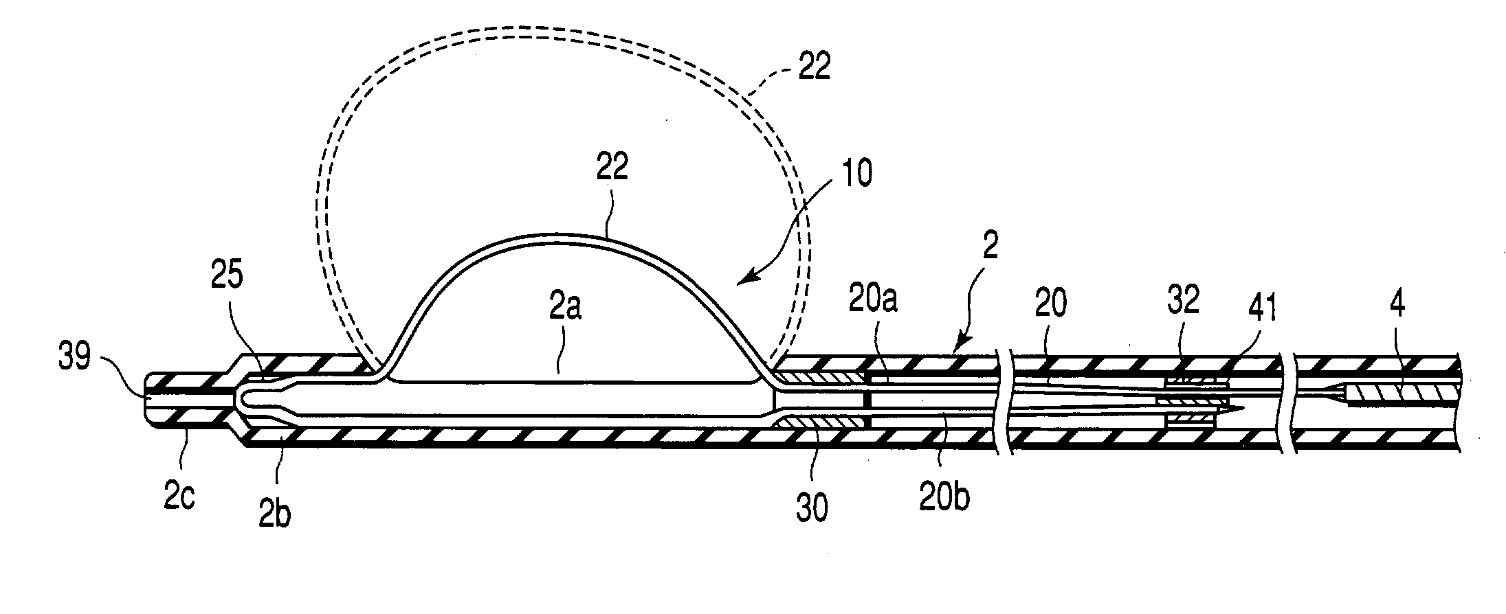 Surgical treatment device