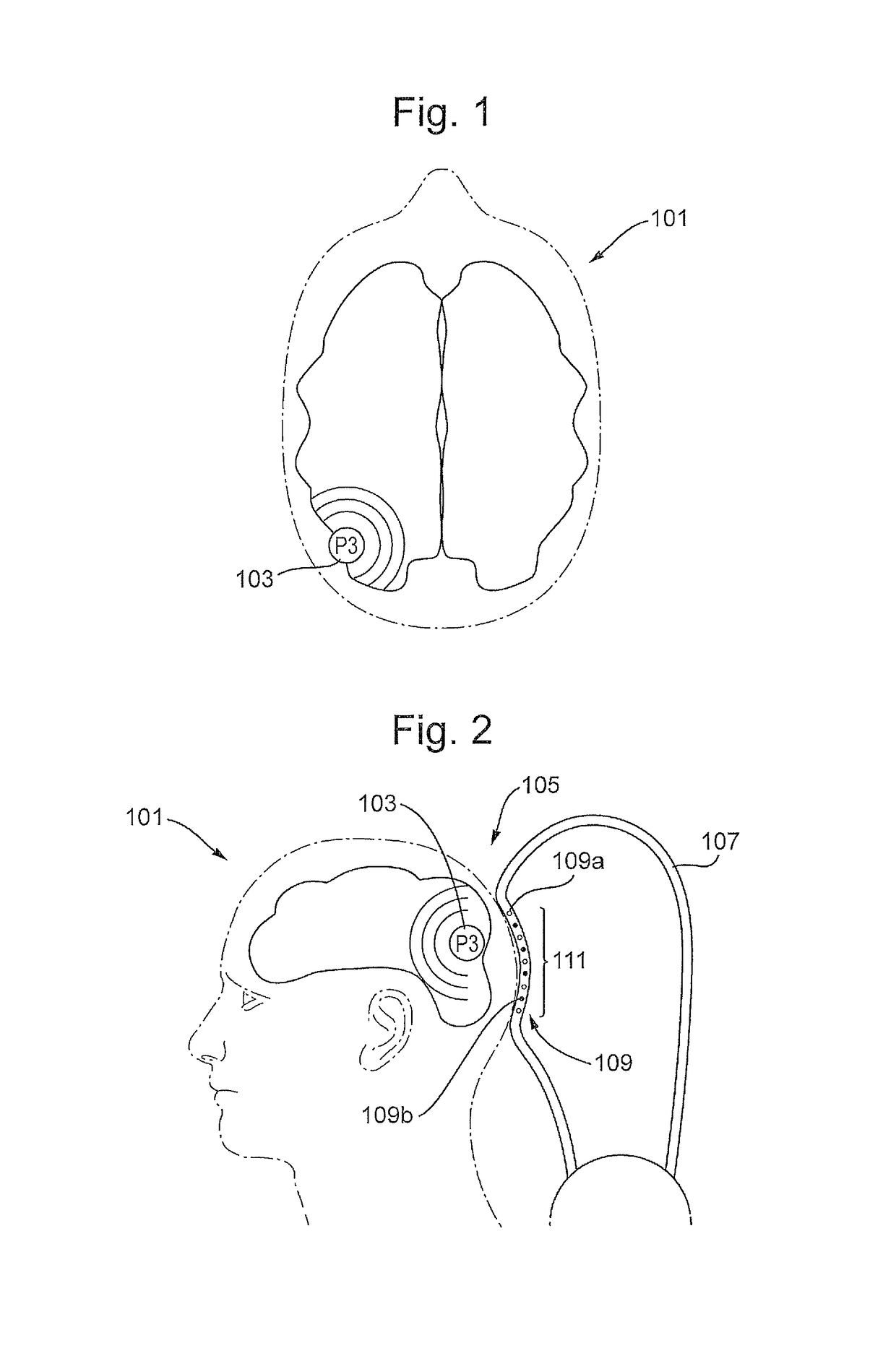 Transcranial neurostimulation system for a vehicle