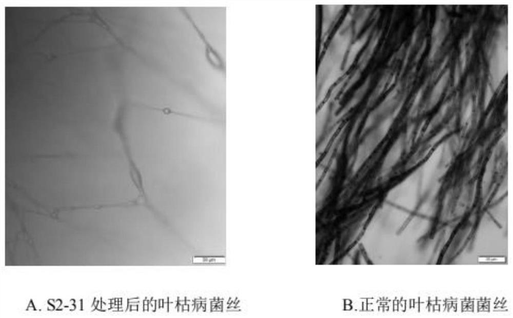 A kind of antagonistic bacterial strain for preventing and treating asarum leaf blight and its application