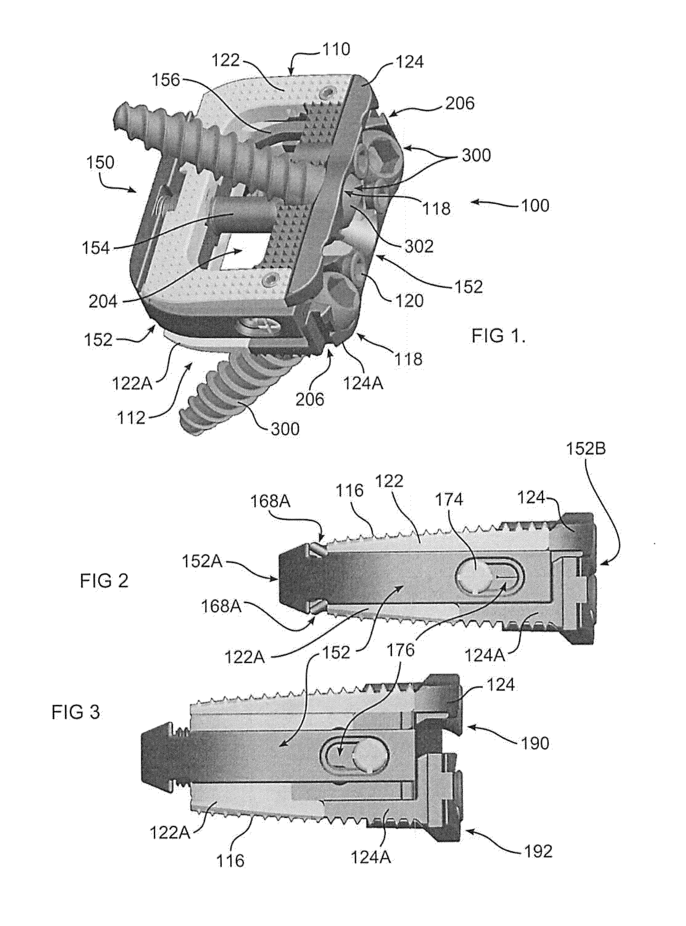 Expandable intervertebral implant