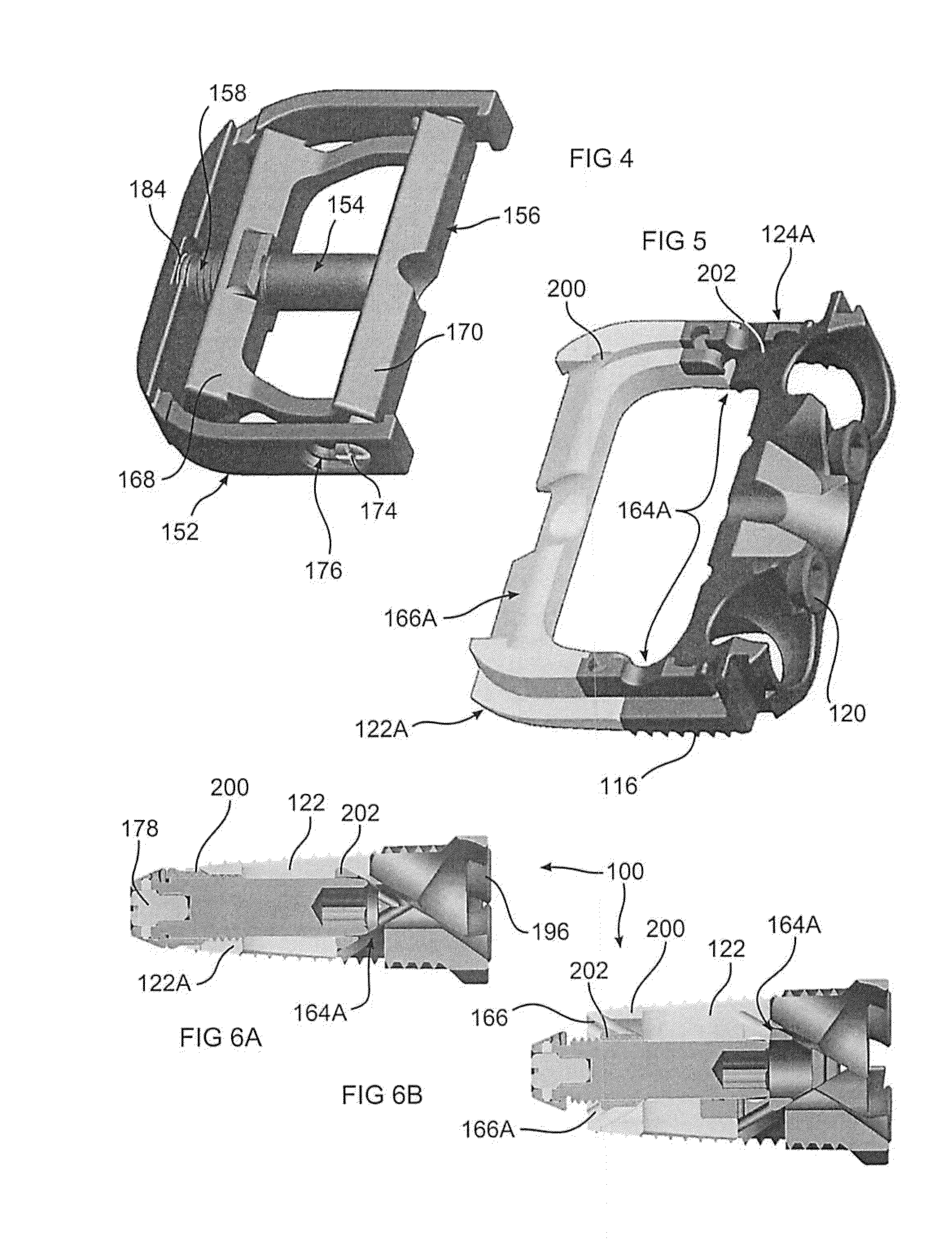 Expandable intervertebral implant