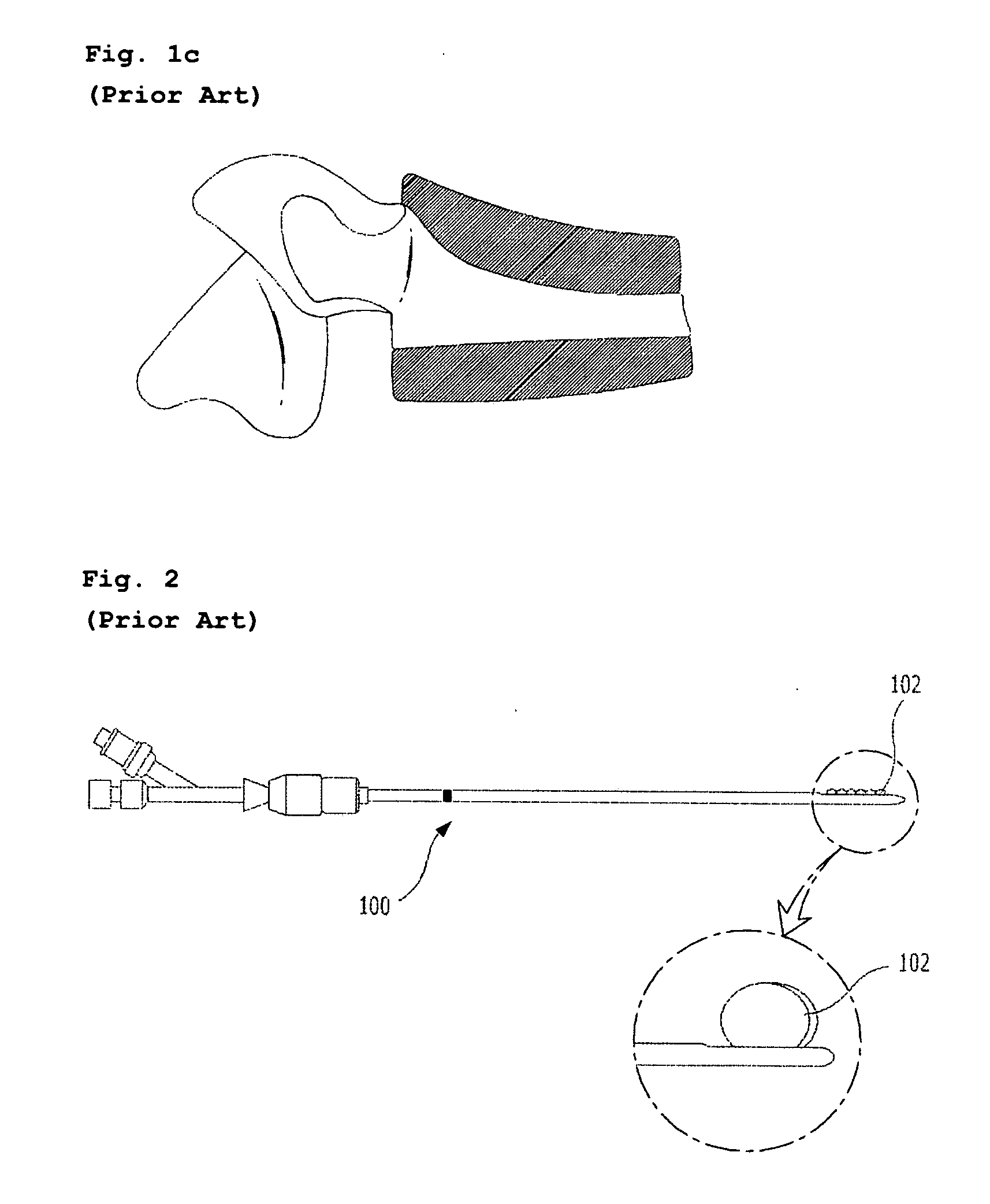 Framework for expanding bone