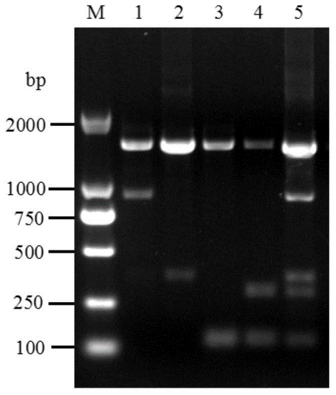 Primer group and method for detecting four kinds of bacteria by means of multiple polymerase chain reaction (PCR)