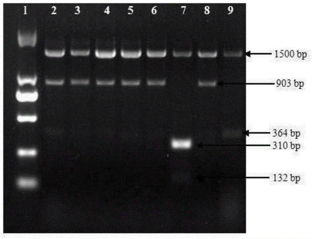 Primer group and method for detecting four kinds of bacteria by means of multiple polymerase chain reaction (PCR)