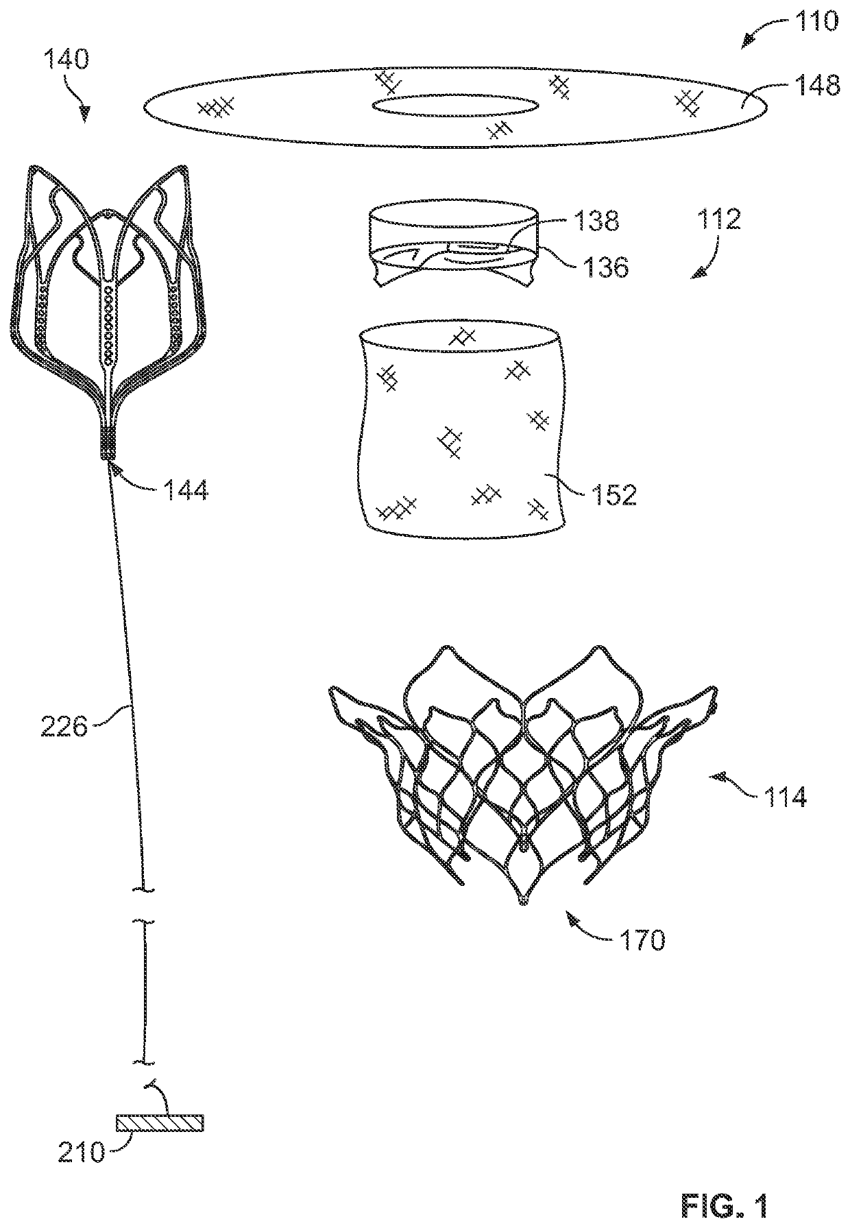 Apparatus And Methods For Minimally Invasive Transcatheter Transapical Puncture, Imaging, and Catheter Alignment Techniques