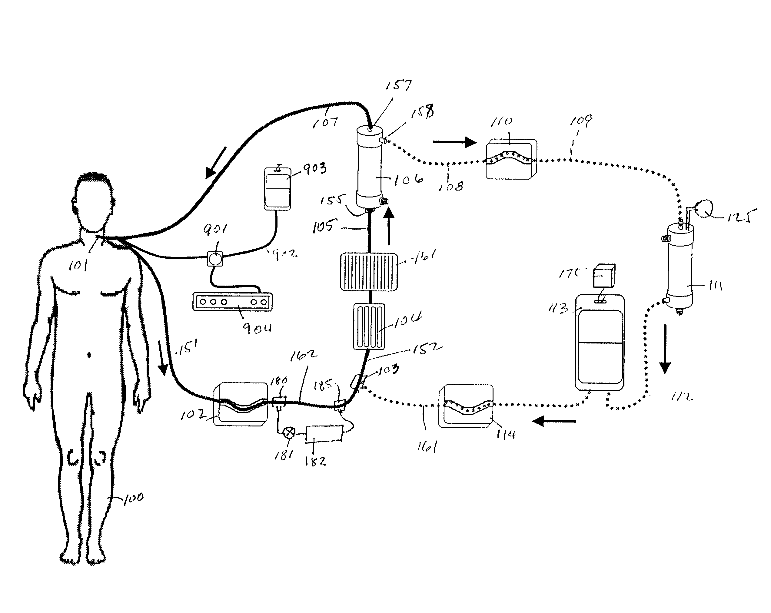 Simplified cerebral retroperfusion apparatus and method