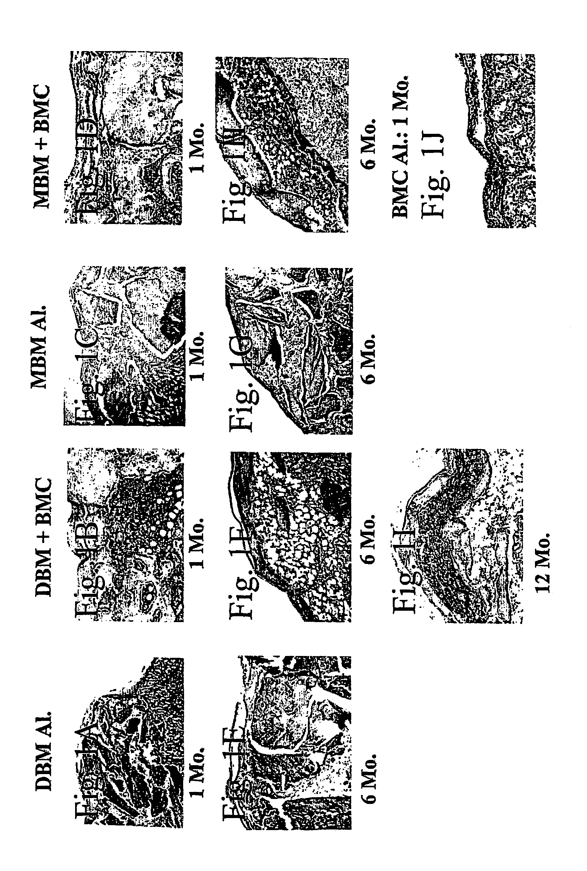 Methods of treatment of hematopoietic disorders