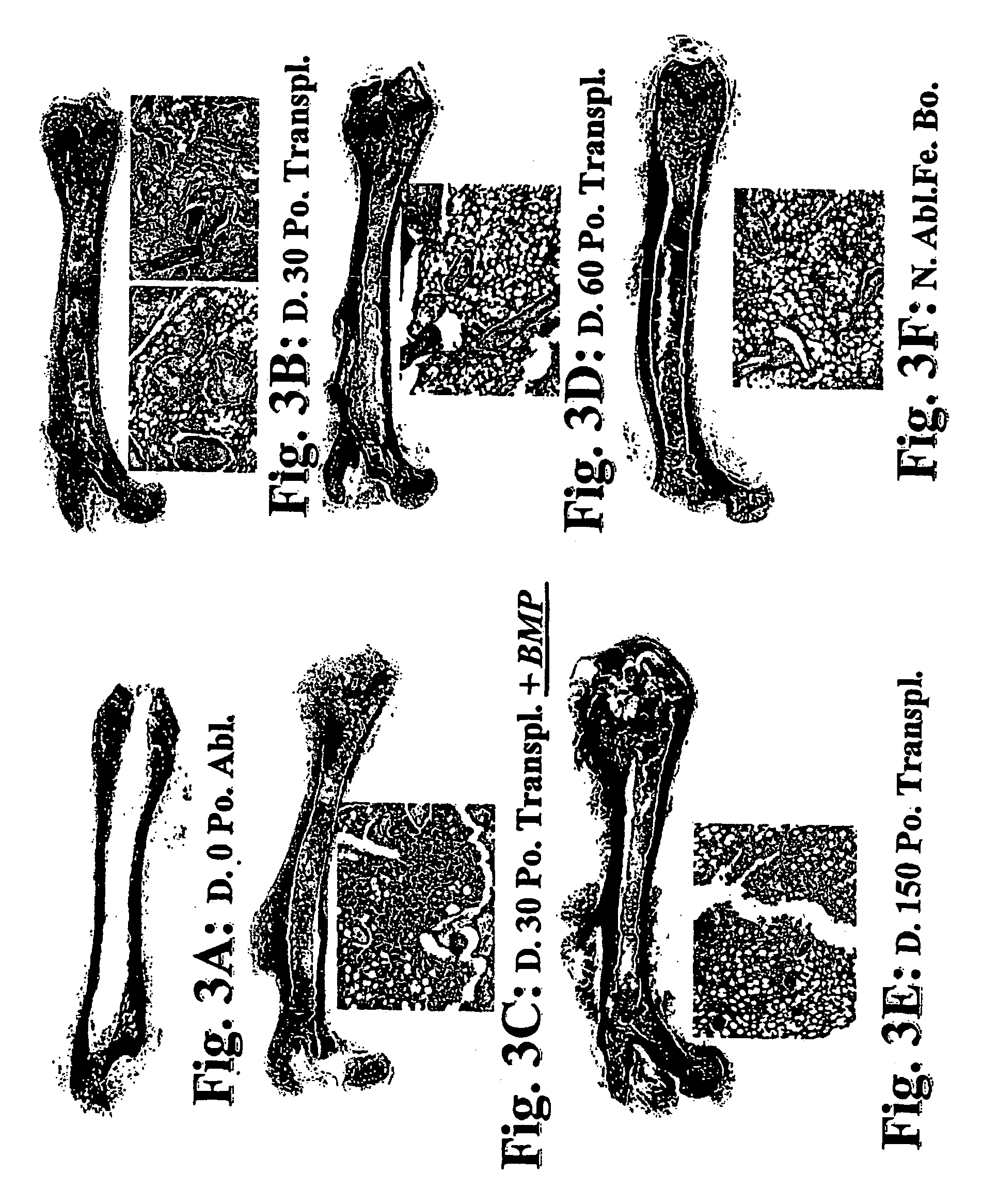 Methods of treatment of hematopoietic disorders