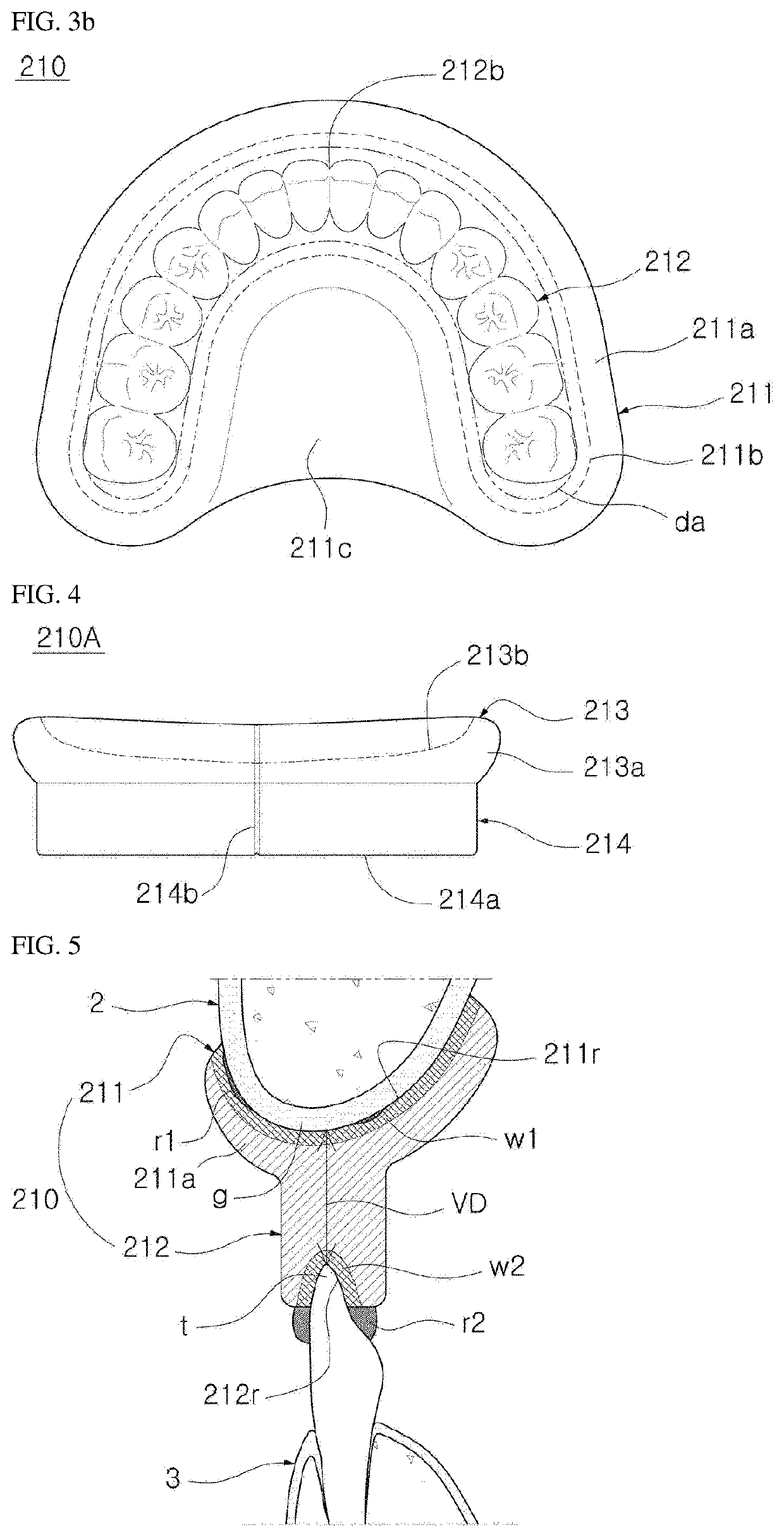 Dental restoration manufacturing method and manufacturing system, and general-purpose wax bite applied thereto