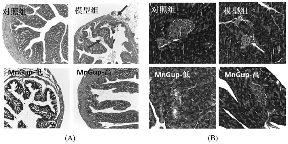Bifidobacterium lactis MN-Gup dairy product and application thereof in improving type 2 diabetes mellitus