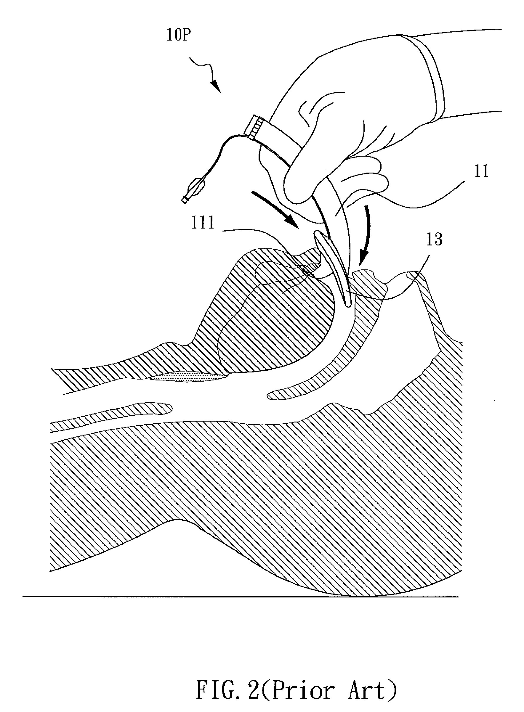 Laryngeal mask airway with a belt, operating piece for controlling the same, and gas supply kit comprising the same