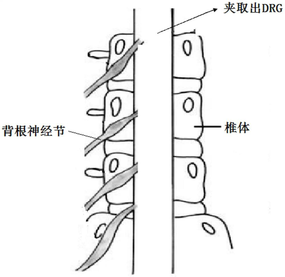 A method for primary culture of dorsal root ganglion satellite glial cells