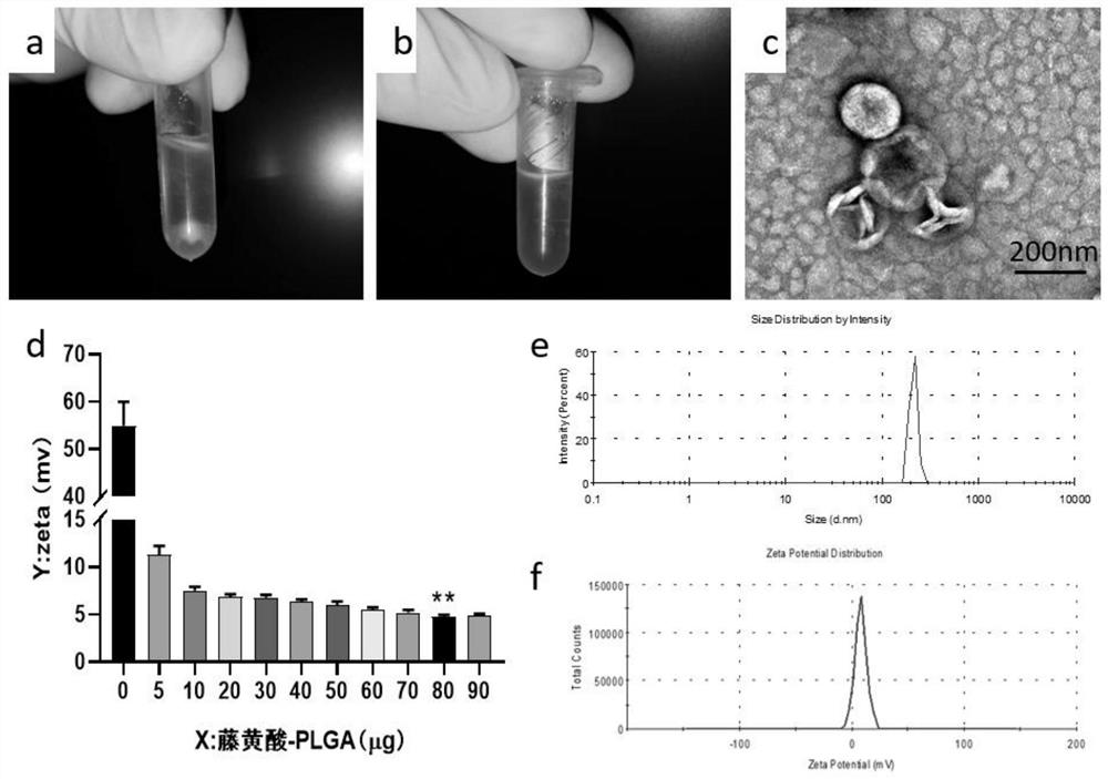 Ultrasonic administration microbubble compound carrying anti-tumor drug as well as preparation method and application of ultrasonic administration microbubble compound