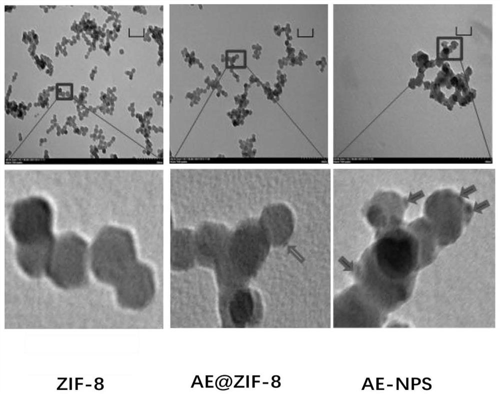 Drug-loaded ZIF-8 nanoparticles covered with TF-PEG-PLGA coating as well as preparation method and application of drug-loaded ZIF-8 nanoparticles