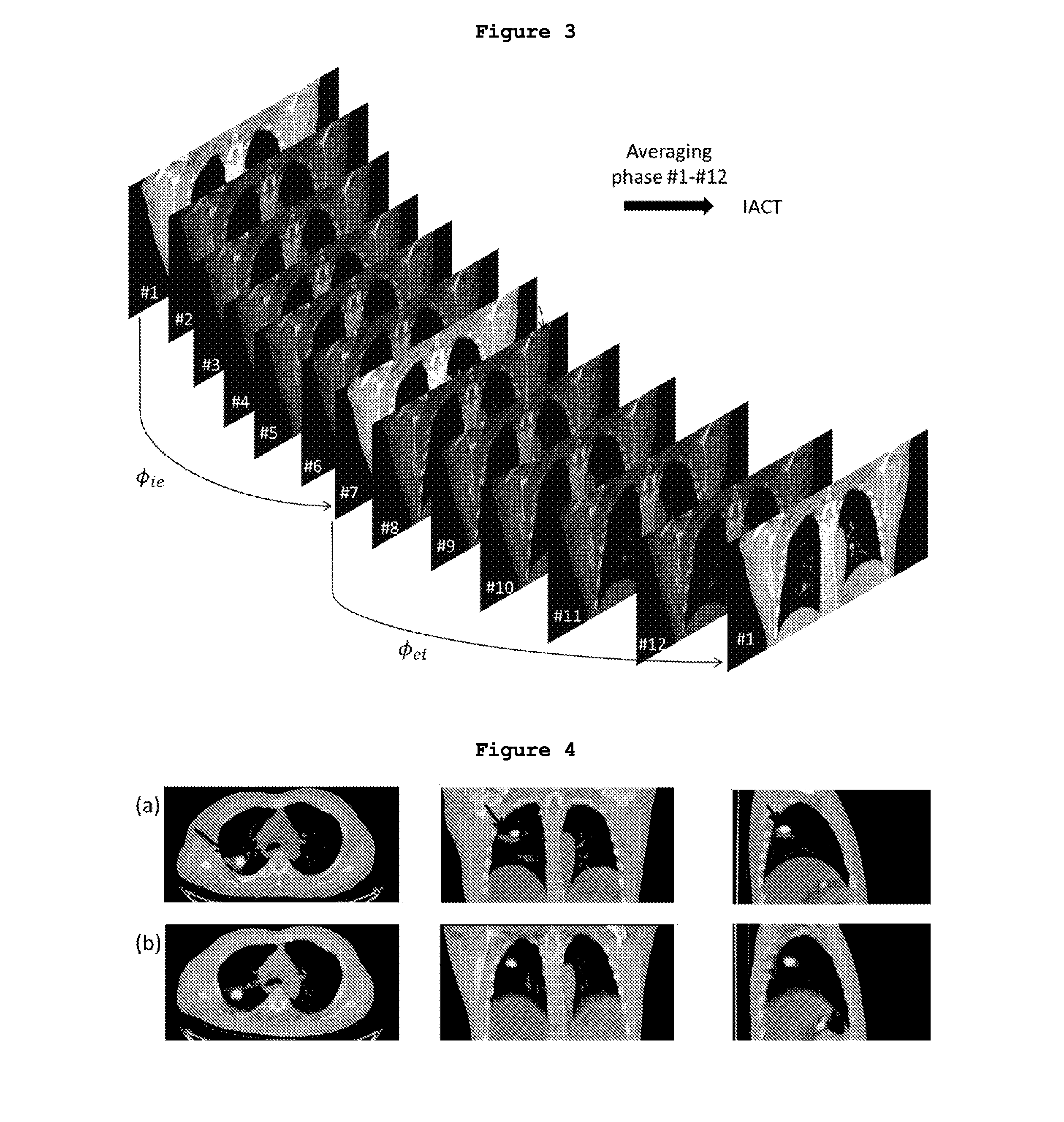 System and method for attenuation correction in  emission computed tomography