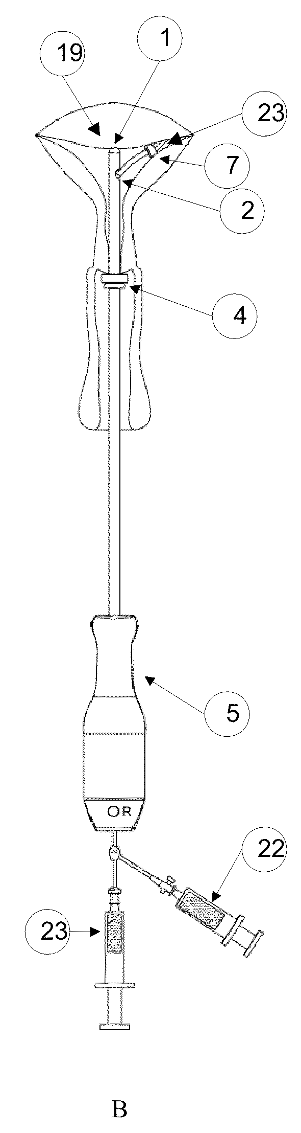 Methods and Devices for Delivery of Compositions to Conduits
