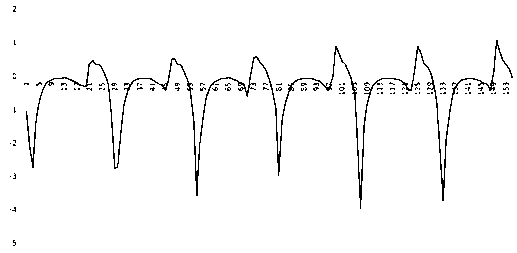 A Method of Step Counting and Behavior Recognition Based on Acceleration Sensor