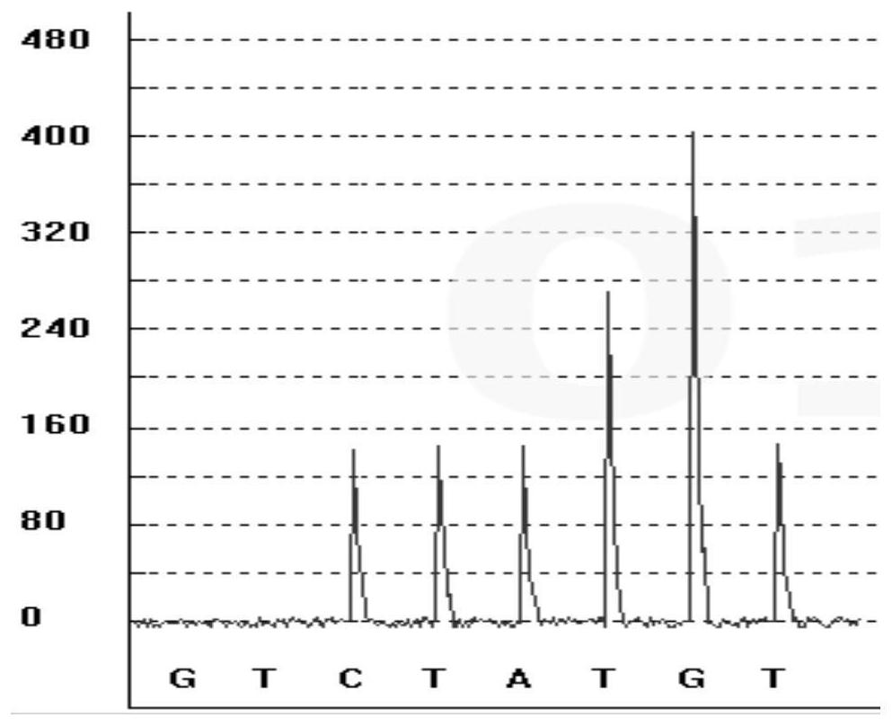 Gene polymorphism detection kit for salbutamol metabolism marker and detection method and use thereof