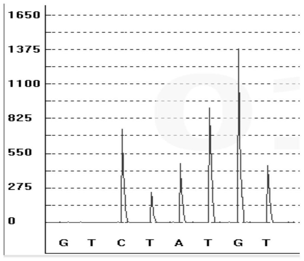 Gene polymorphism detection kit for salbutamol metabolism marker and detection method and use thereof