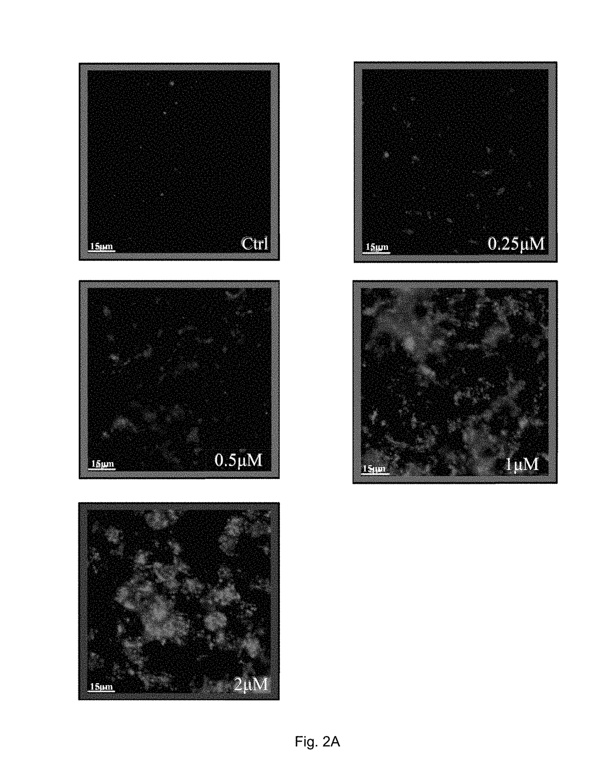 Method of treating refractory rheumatoid arthritis