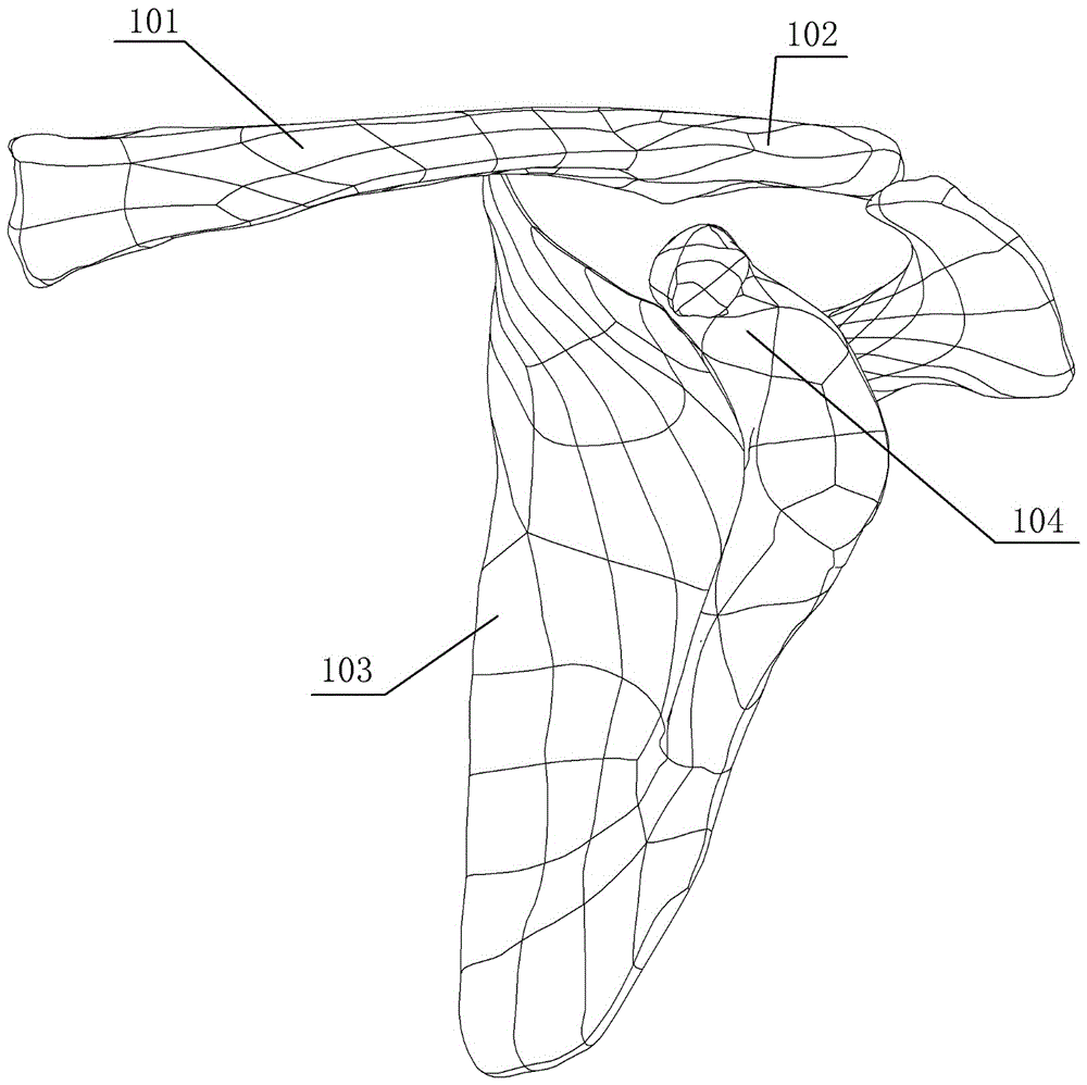 Minimally invasive reparation device for acromioclavicular dislocation