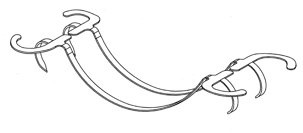 Transvalvular intraannular band for mitral valve repair