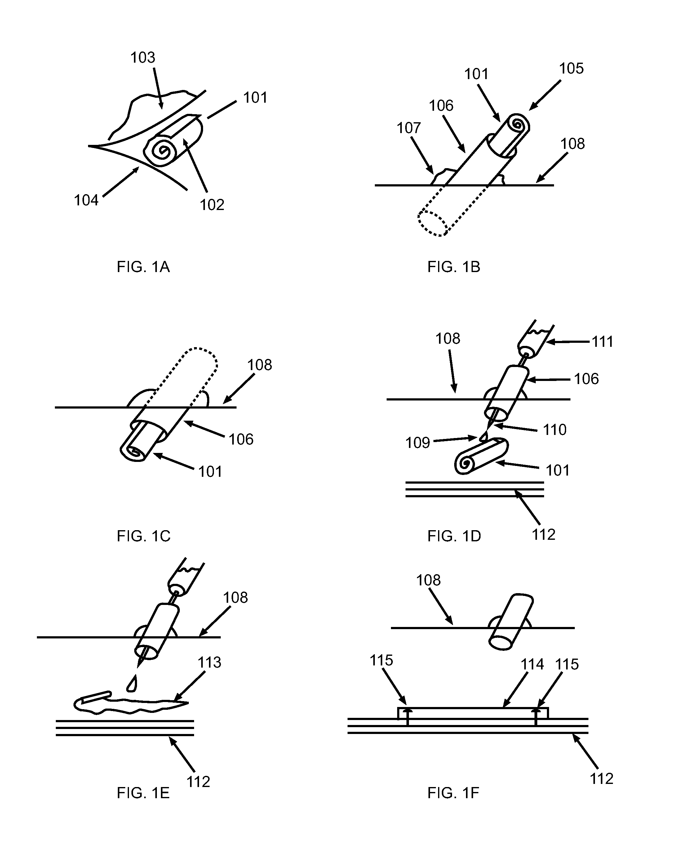 Novel biological implant compositions, implants and methods