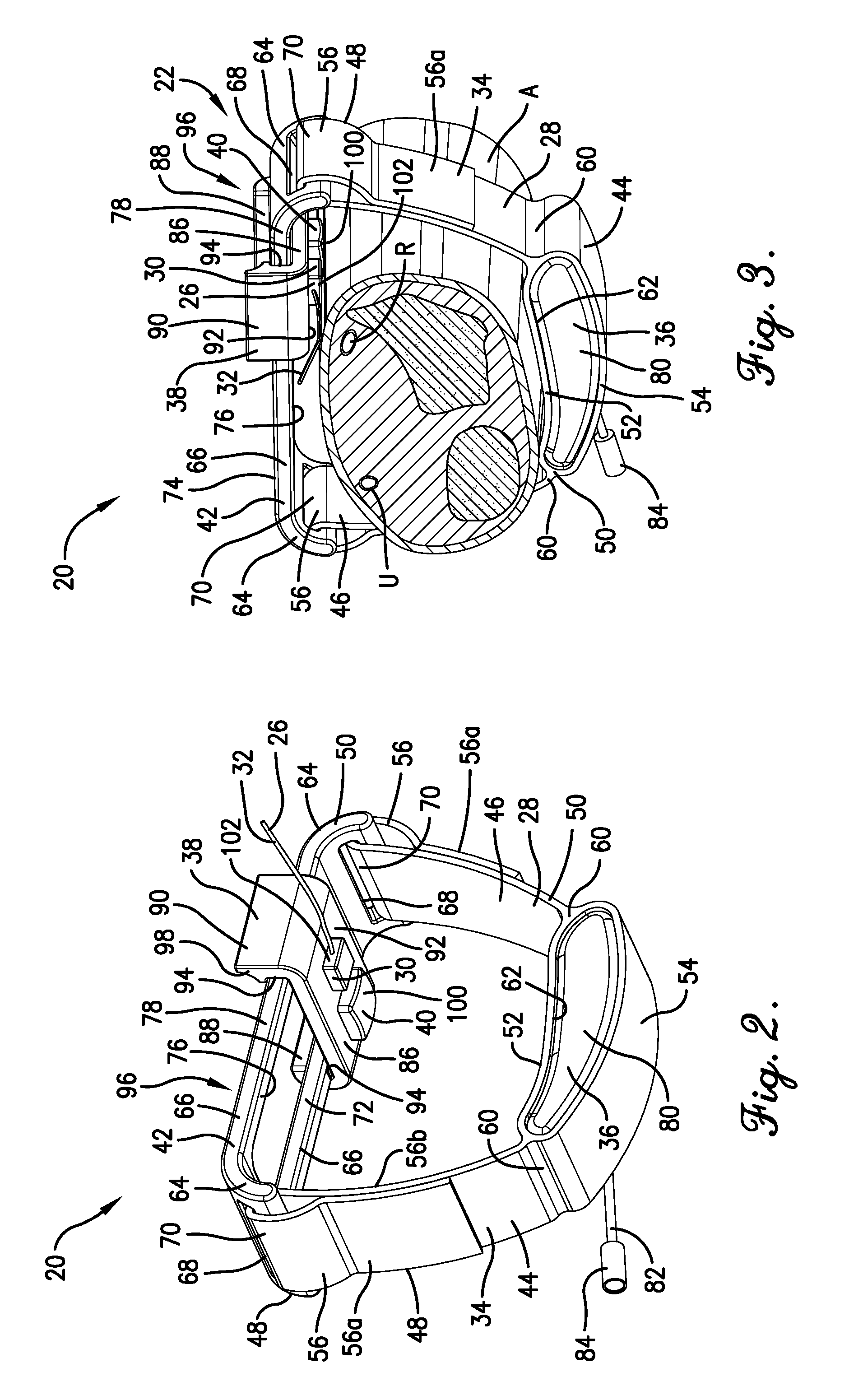 Radial compression hemostasis band with Doppler confirming vascular patency