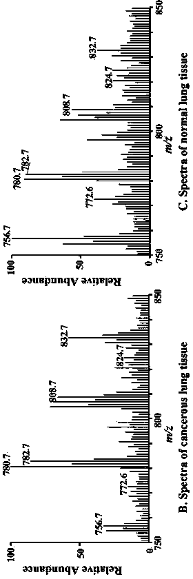 Method for directly analyzing lung cancer tissue sample based on tissue electro-spray ionization mass spectrometry