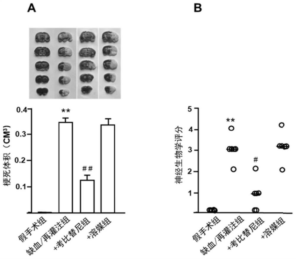 Application of cobimetinib in preparation of medicine for treating ischemia/reperfusion injury and cell protection medicine