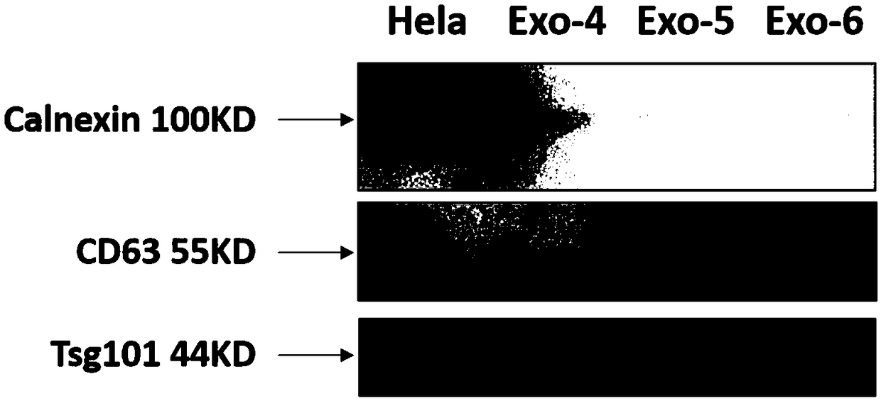 Method for separating and preparing exosome